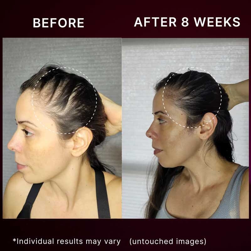 Nail n Mane - Ayuttva - Ayurvedic Supplement For Voluminous Dazzling Hair and Healthy, Bright, Natural Nails - Image 4