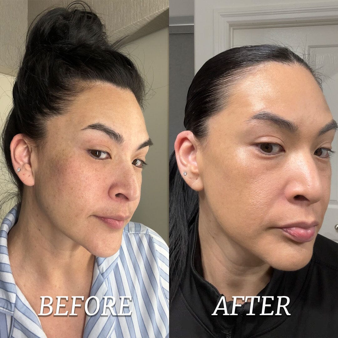 TonEQ: ANTI-PIGMENTATION SUPPLEMENT with 100% NATURAL ACTIVES - For EVEN-TONED, CLEAR & GLOWING SKIN - Image 4